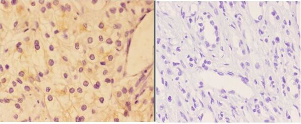 AKAP13 Antibody in Immunohistochemistry (Paraffin) (IHC (P))
