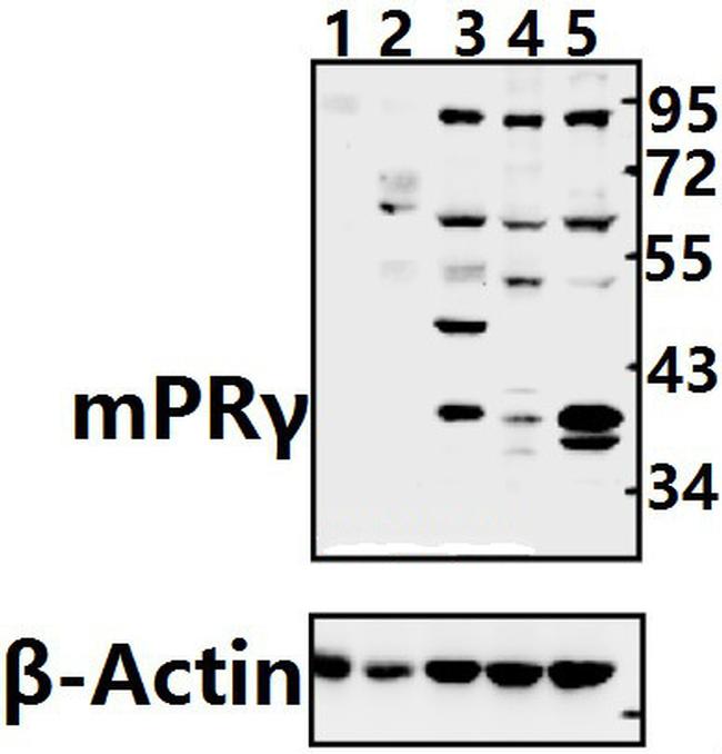 mPR gamma Antibody in Western Blot (WB)