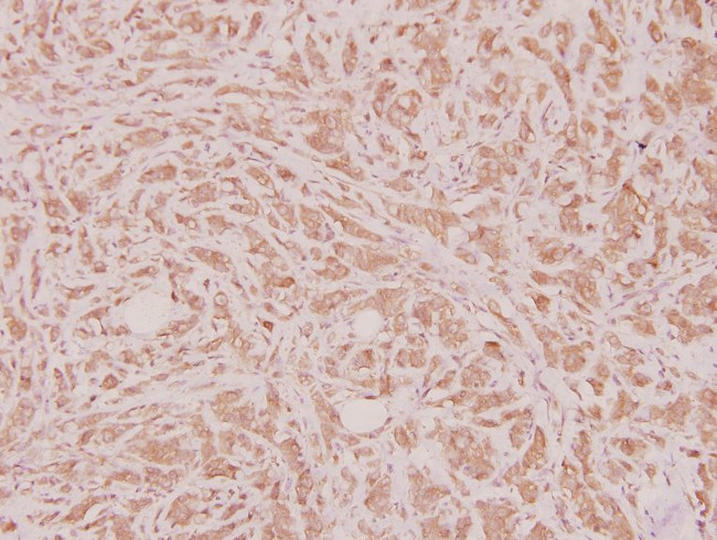 HOXD12 Antibody in Immunohistochemistry (Paraffin) (IHC (P))