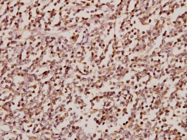 SRSF4 Antibody in Immunohistochemistry (Paraffin) (IHC (P))