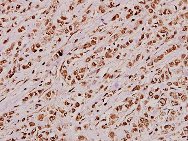 JIP3 Antibody in Immunohistochemistry (Paraffin) (IHC (P))