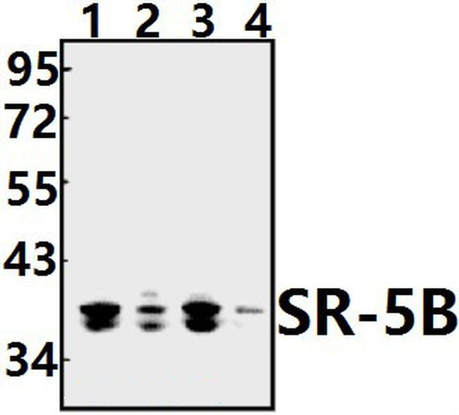 HTR5B Antibody in Western Blot (WB)