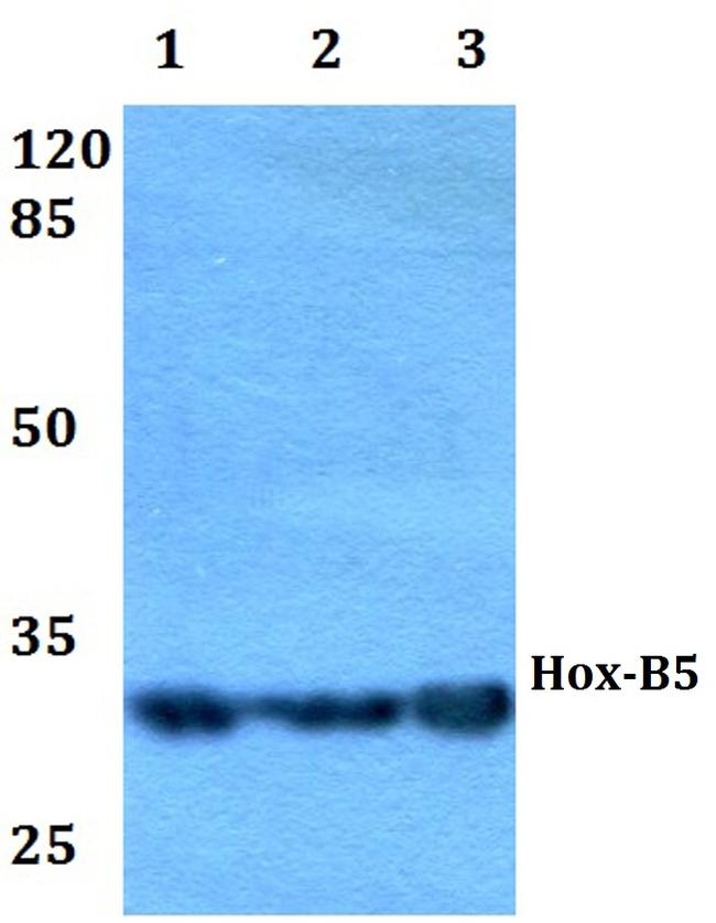 HOXB5 Antibody in Western Blot (WB)