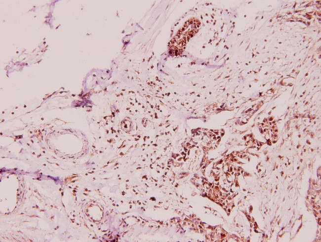 Apolipoprotein L2 Antibody in Immunohistochemistry (Paraffin) (IHC (P))