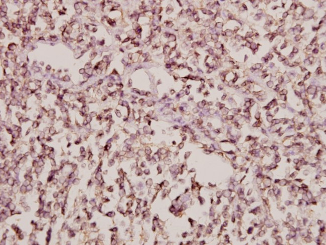 Arfaptin 1 Antibody in Immunohistochemistry (Paraffin) (IHC (P))