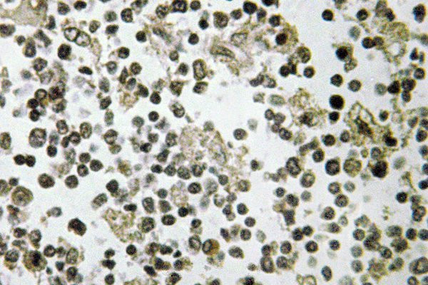 DDX55 Antibody in Immunohistochemistry (Paraffin) (IHC (P))