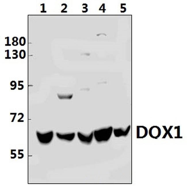 DQX1 Antibody in Western Blot (WB)