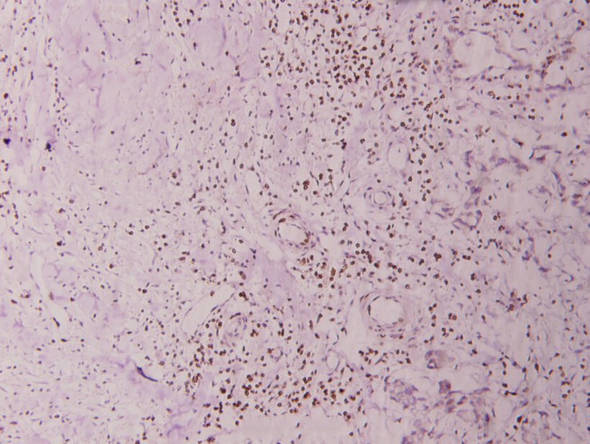 BRP44L Antibody in Immunohistochemistry (Paraffin) (IHC (P))
