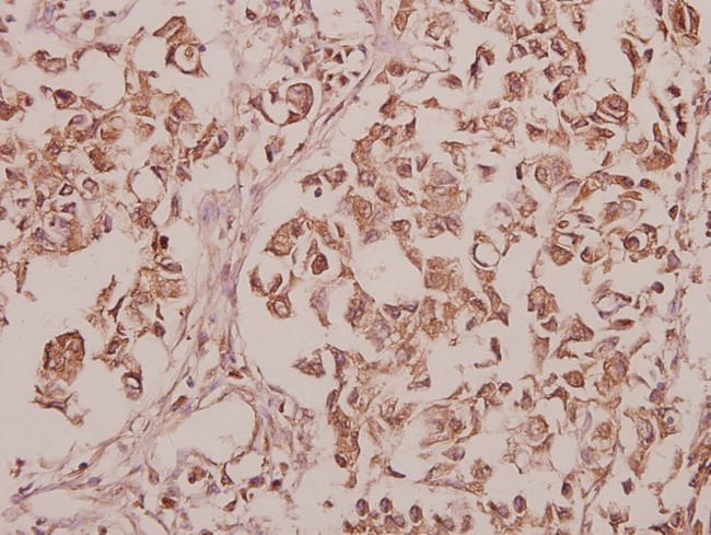 CEP135 Antibody in Immunohistochemistry (Paraffin) (IHC (P))