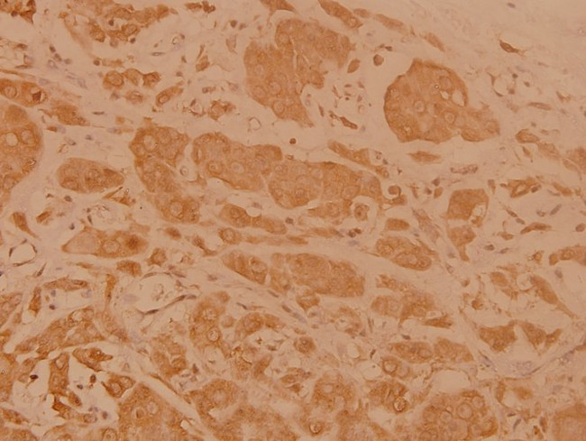 Cerebral Protein 1 Antibody in Immunohistochemistry (Paraffin) (IHC (P))