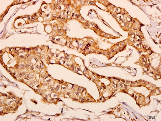 GNPAT Antibody in Immunohistochemistry (Paraffin) (IHC (P))