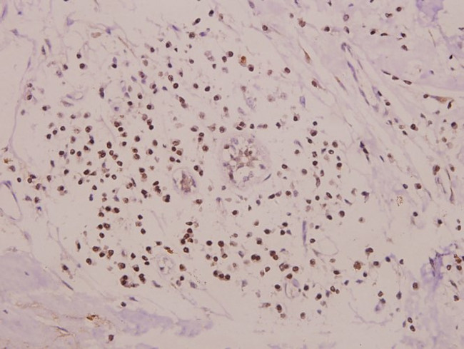RRAD Antibody in Immunohistochemistry (Paraffin) (IHC (P))