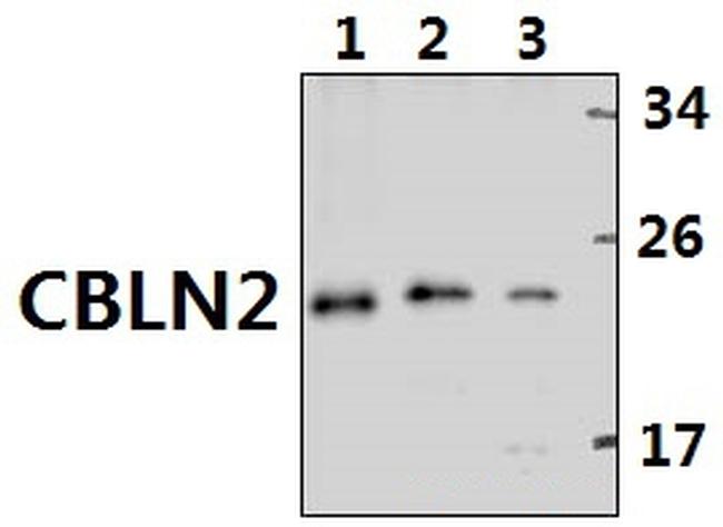 Cerebellin 2 Antibody in Western Blot (WB)