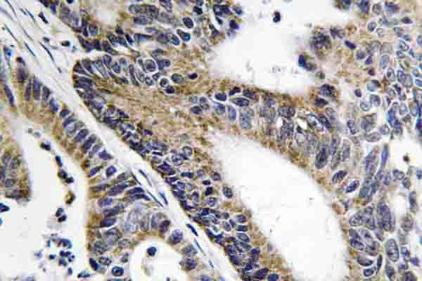 IQCB1 Antibody in Immunohistochemistry (Paraffin) (IHC (P))