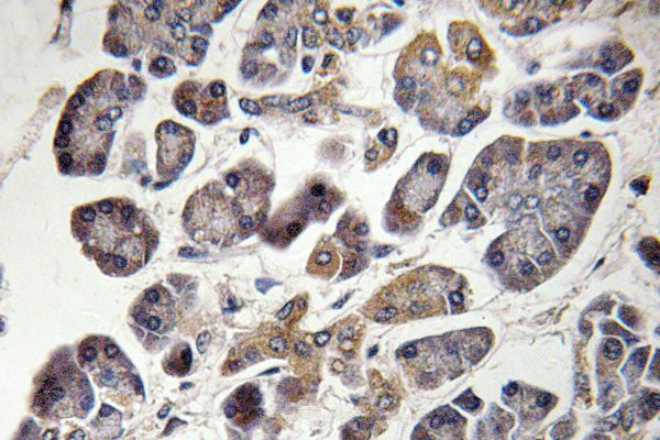 MRPS21 Antibody in Immunohistochemistry (Paraffin) (IHC (P))