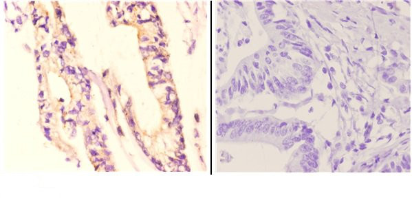 NDUFA8 Antibody in Immunohistochemistry (Paraffin) (IHC (P))
