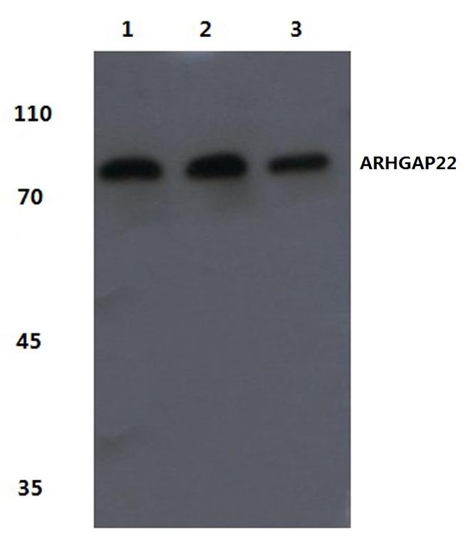 ARHGAP22 Antibody in Western Blot (WB)