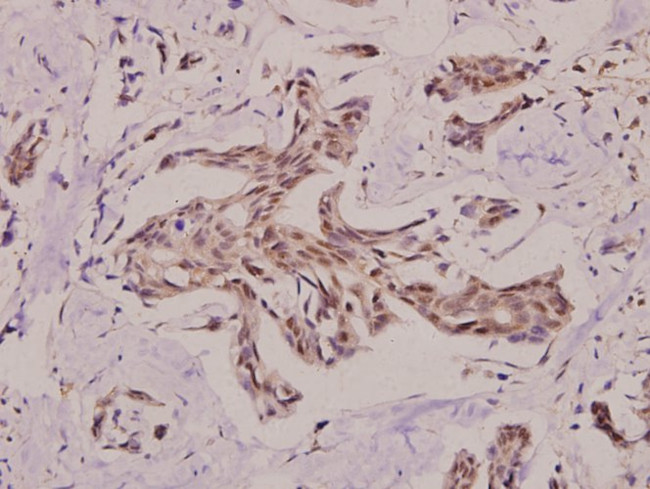 PRKY Antibody in Immunohistochemistry (Paraffin) (IHC (P))