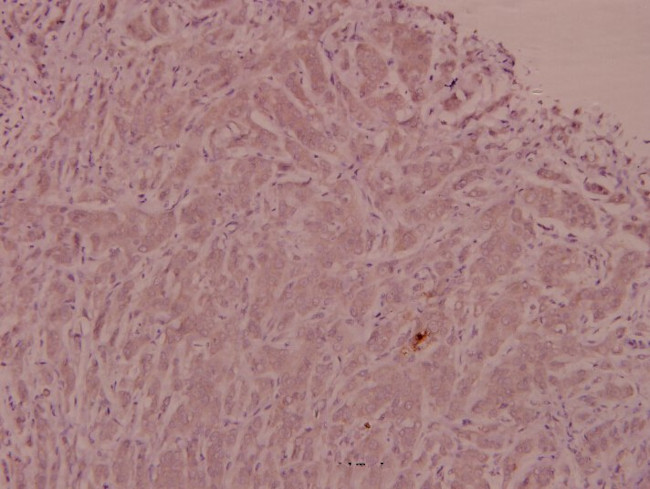Adrenomedullin Antibody in Immunohistochemistry (Paraffin) (IHC (P))