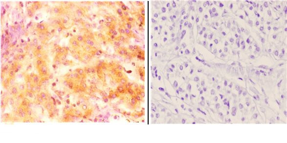INHBC Antibody in Immunohistochemistry (Paraffin) (IHC (P))