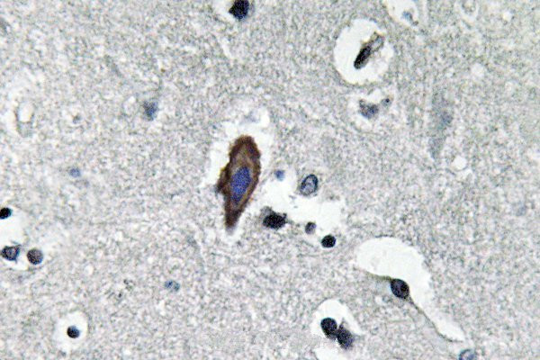 Aquaporin 0 Antibody in Immunohistochemistry (Paraffin) (IHC (P))