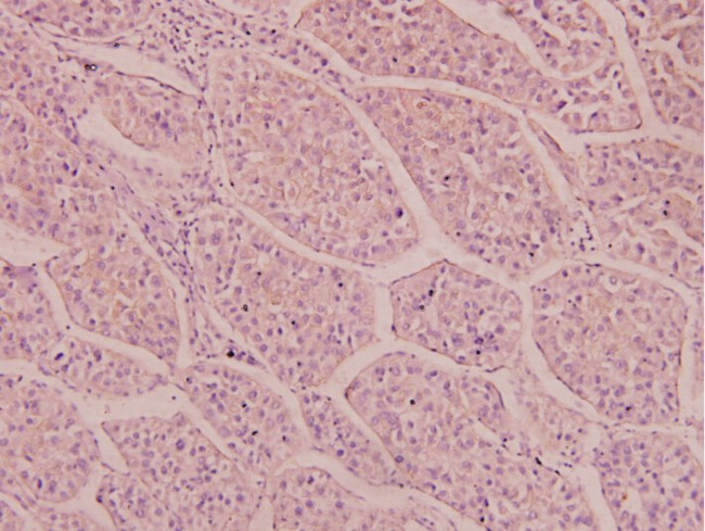 NMDAR2D Antibody in Immunohistochemistry (Paraffin) (IHC (P))