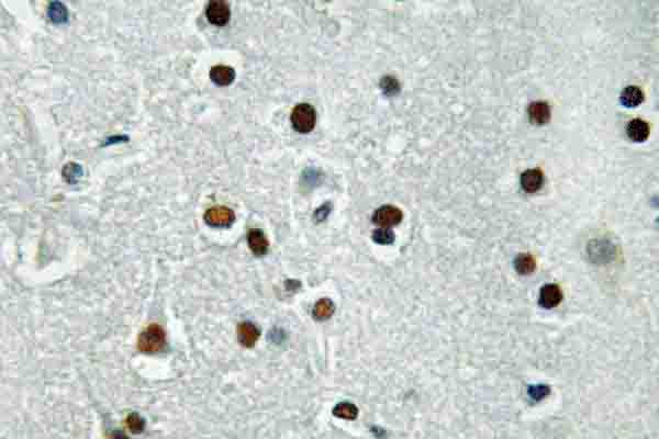 ASCL1 Antibody in Immunohistochemistry (Paraffin) (IHC (P))