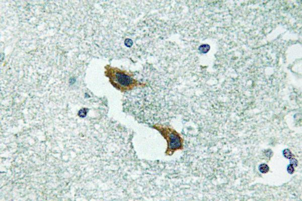 ATP7A Antibody in Immunohistochemistry (Paraffin) (IHC (P))