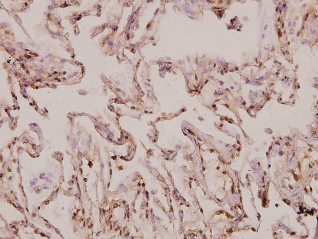 MRPS9 Antibody in Immunohistochemistry (Paraffin) (IHC (P))