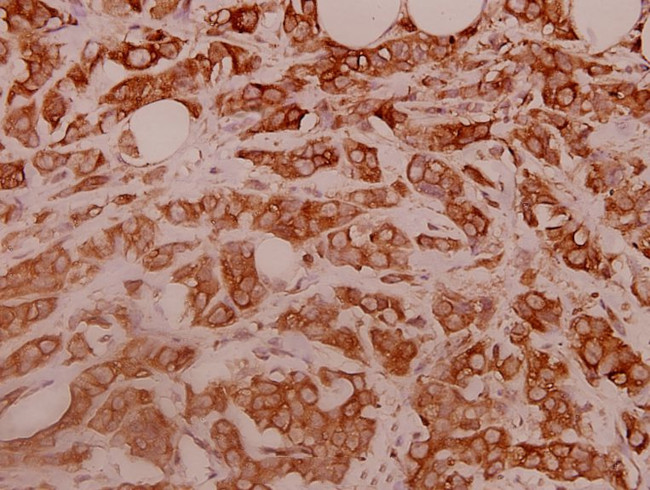 RPS11 Antibody in Immunohistochemistry (Paraffin) (IHC (P))