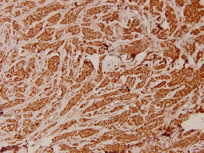 ATP5I Antibody in Immunohistochemistry (Paraffin) (IHC (P))