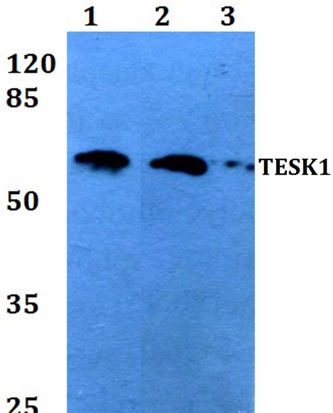 TESK1 Antibody in Western Blot (WB)