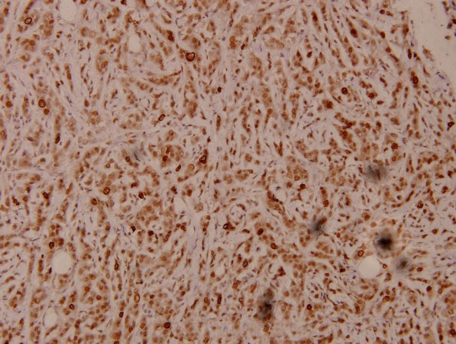 PEX7 Antibody in Immunohistochemistry (Paraffin) (IHC (P))