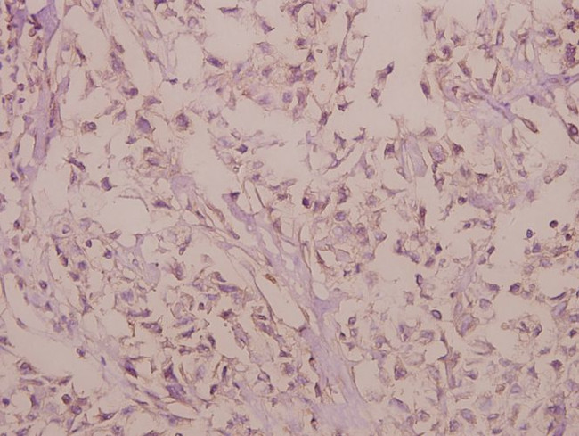 RhoG Antibody in Immunohistochemistry (Paraffin) (IHC (P))