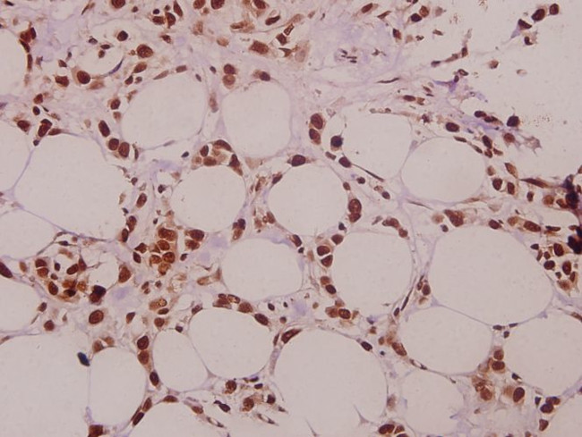 SFRS15 Antibody in Immunohistochemistry (Paraffin) (IHC (P))