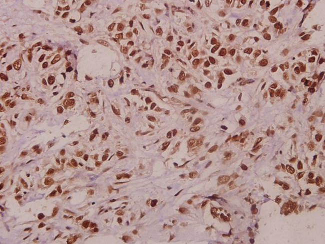 TCEAL1 Antibody in Immunohistochemistry (Paraffin) (IHC (P))