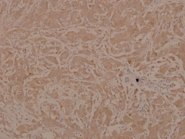 Phospho-ASK1 (Ser83) Antibody in Immunohistochemistry (Paraffin) (IHC (P))