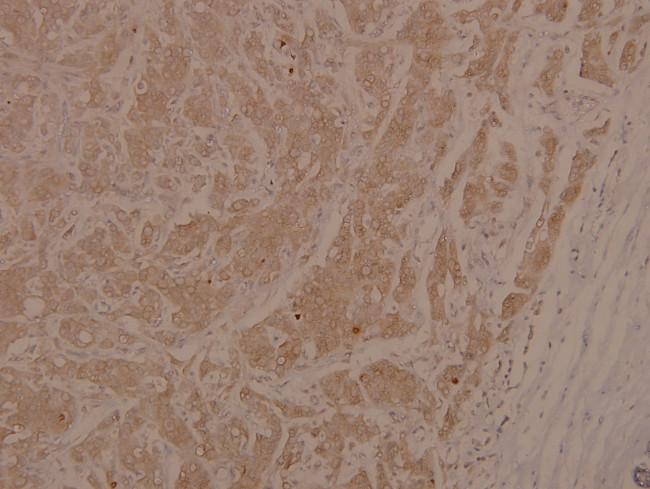 Phospho-ASK1 (Ser966) Antibody in Immunohistochemistry (Paraffin) (IHC (P))