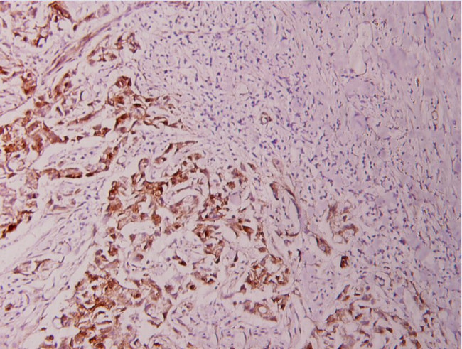 Phospho-Bcl-2 (Thr56) Antibody in Immunohistochemistry (Paraffin) (IHC (P))
