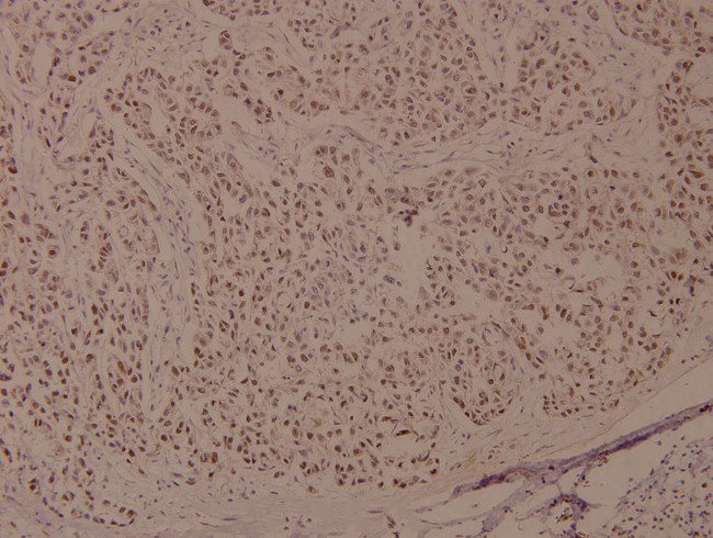 Phospho-BRCA1 (Ser1524) Antibody in Immunohistochemistry (Paraffin) (IHC (P))