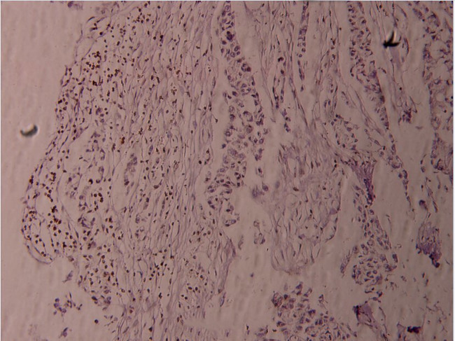 Phospho-Fyn (Tyr530) Antibody in Immunohistochemistry (Paraffin) (IHC (P))