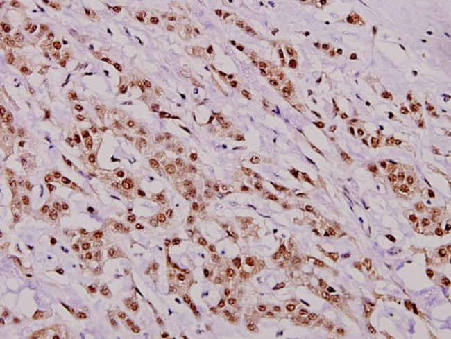 Phospho-HDAC8 (Ser39) Antibody in Immunohistochemistry (Paraffin) (IHC (P))