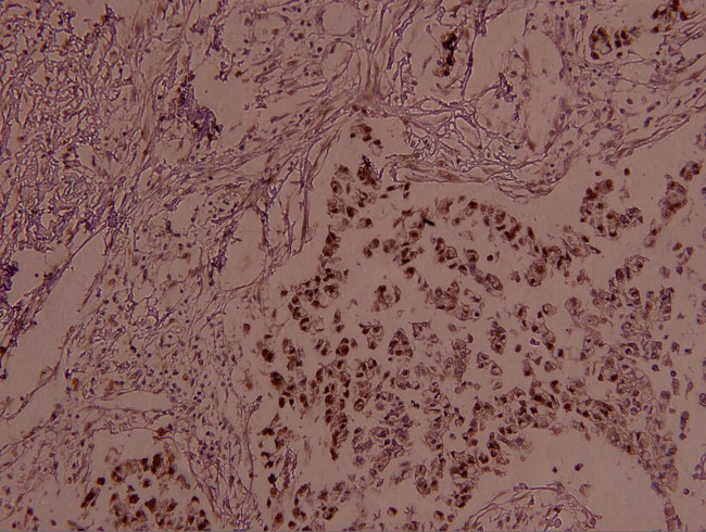 Phospho-JunB (Ser259) Antibody in Immunohistochemistry (Paraffin) (IHC (P))