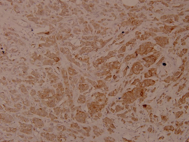 Phospho-Cytokeratin 18 (Ser33) Antibody in Immunohistochemistry (Paraffin) (IHC (P))