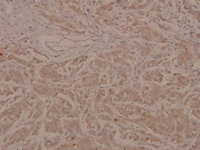 Phospho-MEF2A (Thr319) Antibody in Immunohistochemistry (Paraffin) (IHC (P))