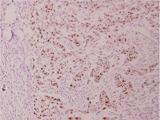 Phospho-c-Myc (Thr358) Antibody in Immunohistochemistry (Paraffin) (IHC (P))