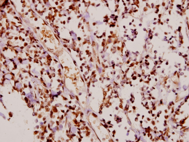 Phospho-p21 (Thr145) Antibody in Immunohistochemistry (Paraffin) (IHC (P))