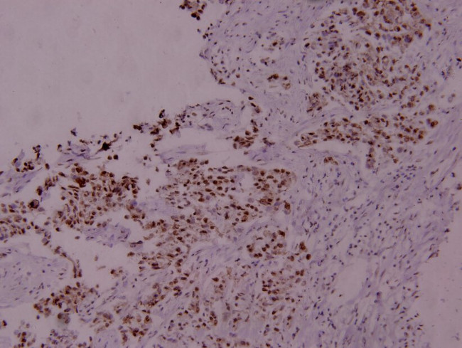 Phospho-STAT5 alpha (Ser780) Antibody in Immunohistochemistry (Paraffin) (IHC (P))