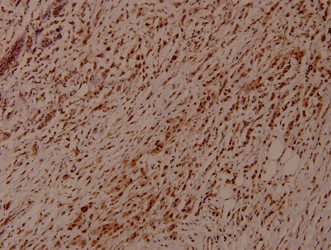 Phospho-Synaptotagmin 1/2 (Thr202, Thr199) Antibody in Immunohistochemistry (Paraffin) (IHC (P))