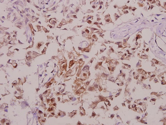 Phospho-Tyrosine Hydroxylase (Ser71) Antibody in Immunohistochemistry (Paraffin) (IHC (P))